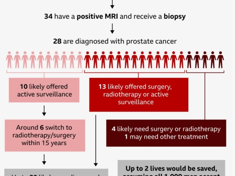 Prostate Cancer [Mandatory]&nbsp;Screening